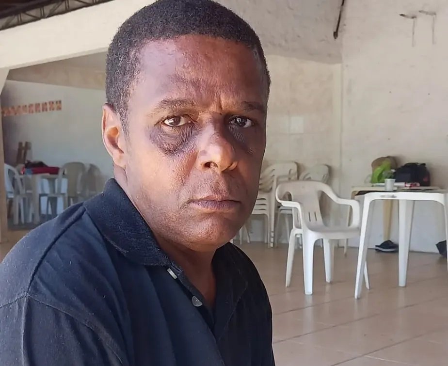 Inocente baleado em comunidade de Niterói tem estado de saúde estável