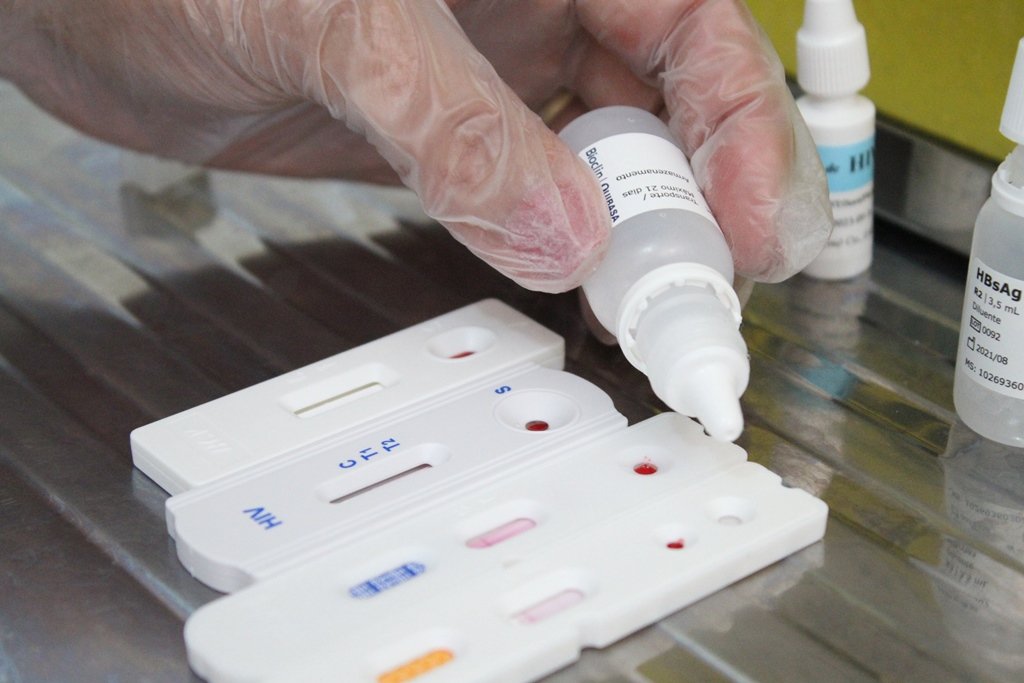 São Gonçalo reforça ações contra hepatites virais