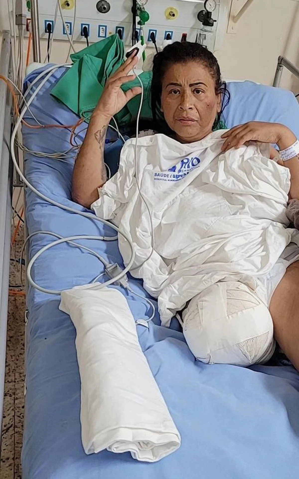 MC Katia pede ajuda aos fãs após ter que amputar a perna