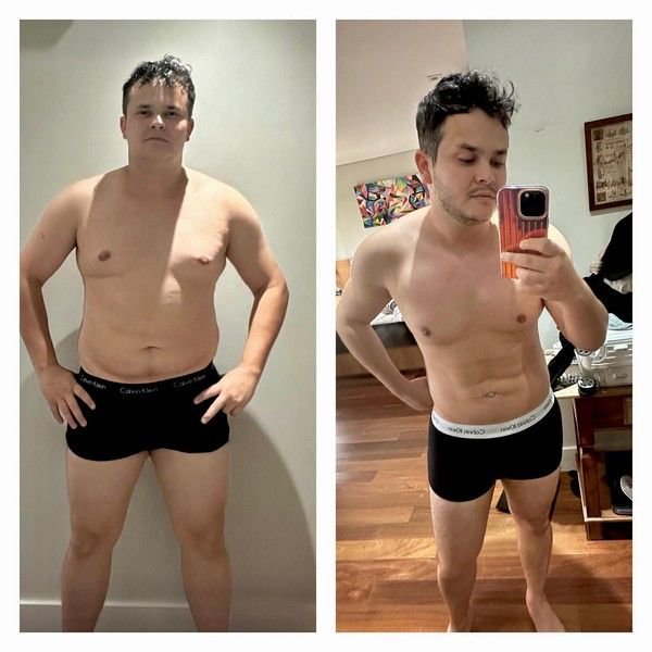Lipo LAD: A Escolha dos Famosos para Definir o Corpo