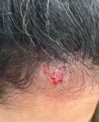 Mais um morador em situação de rua é denunciado por agressão