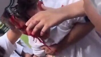 Estudante é ferido após ser agredido a pedradas por colega no Rio