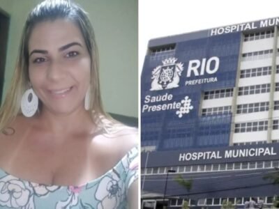 Mulher queimada em estação de trem, no Rio: estado gravíssimo