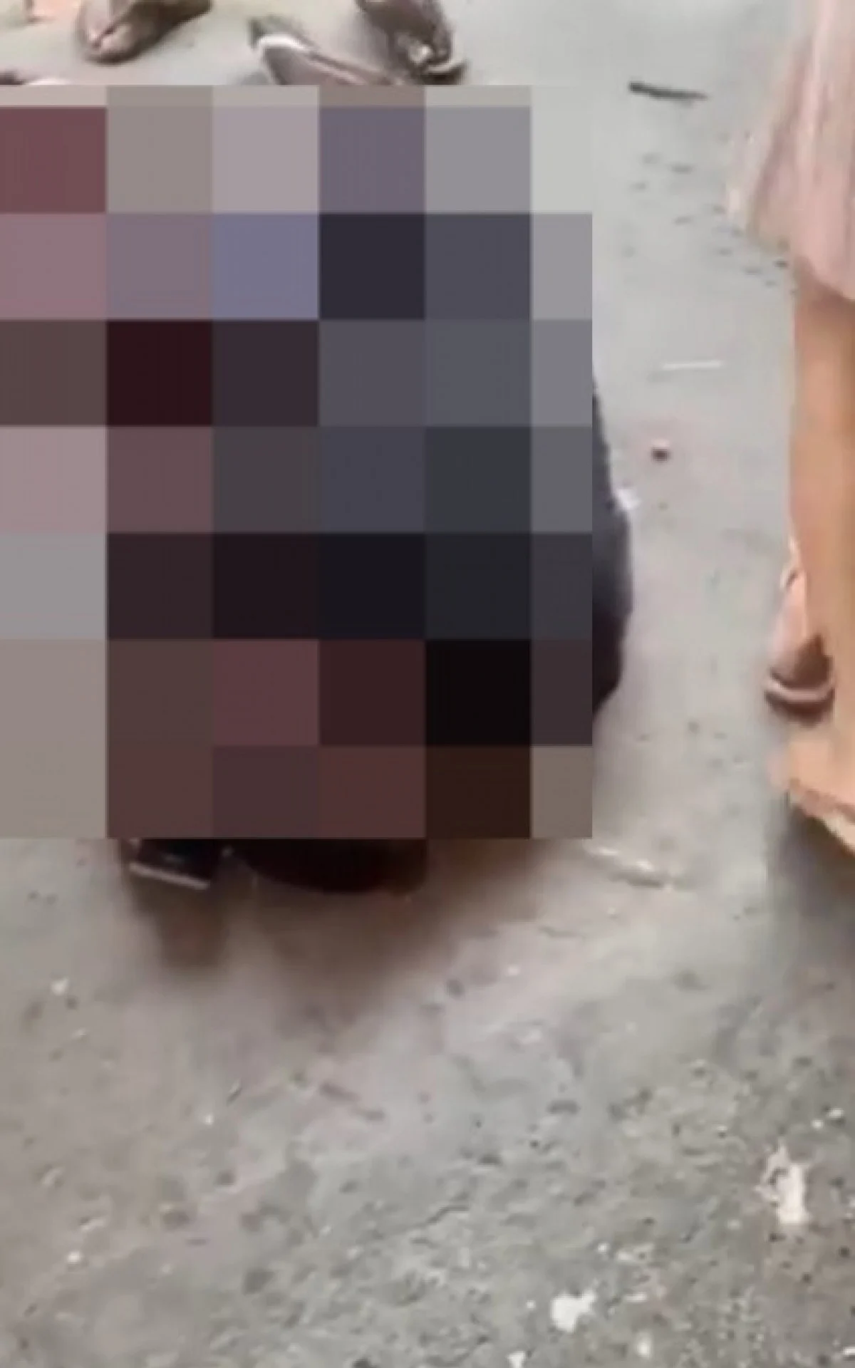 Menino baleado em Caxias luta pela vida após cirurgia