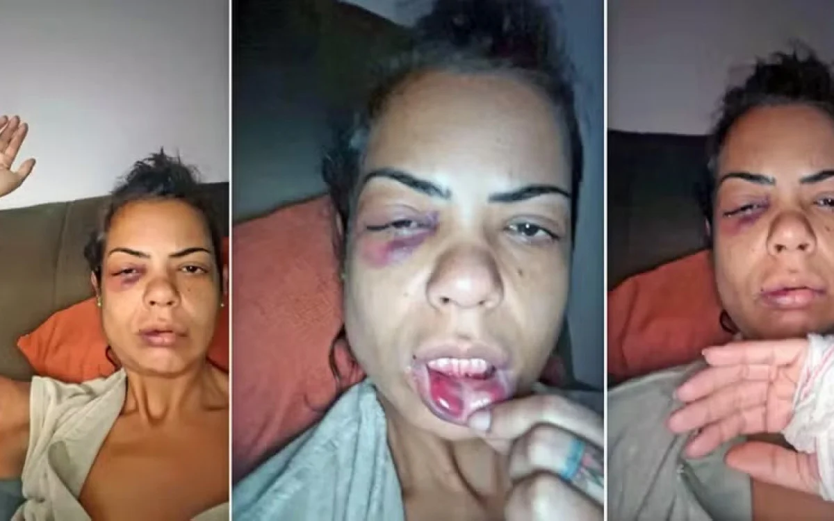 Professora é brutalmente agredida por casal após briga de trânsito