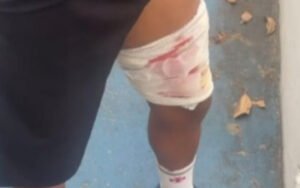 Homem é baleado enquanto corria na Baixada - Vídeo