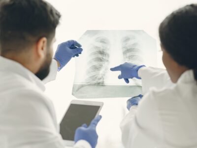 Câncer: Estudo com IA feito no Hospital Antônio Pedro, em Niterói revoluciona tratamento