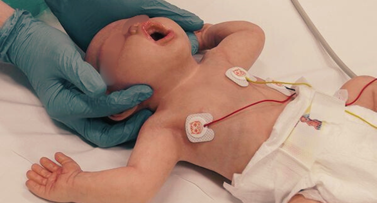 Bebês com doenças cardíacas terão cirurgias garantidas pelo SUS em novo hospital