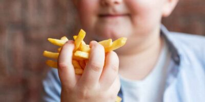 Batata frita é um alimento que pode fazer a criança desenvolver obesidade. Foto: Reprodução/internet.